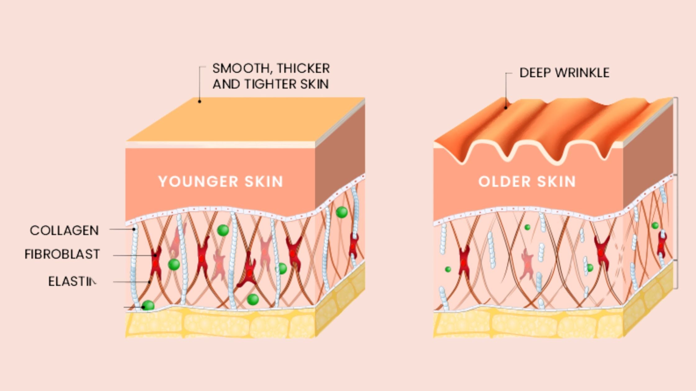 Collageen tekort, dit zijn de symptomen en oorzaken!