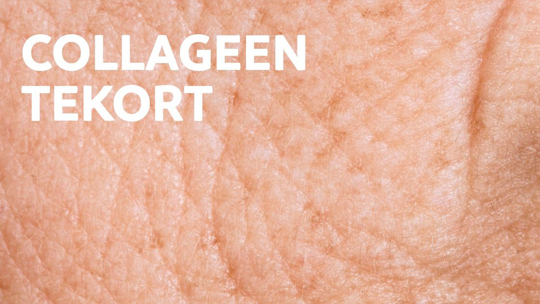 Collageen tekort, dit zijn de symptomen en oorzaken!