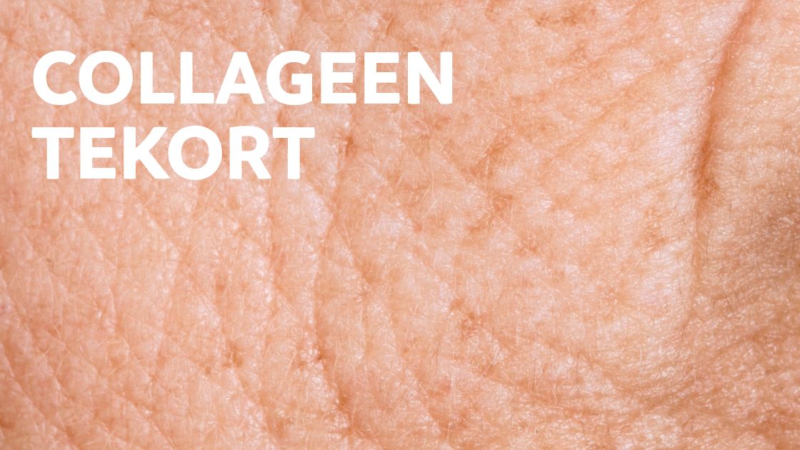 een close up van een verouderde huid