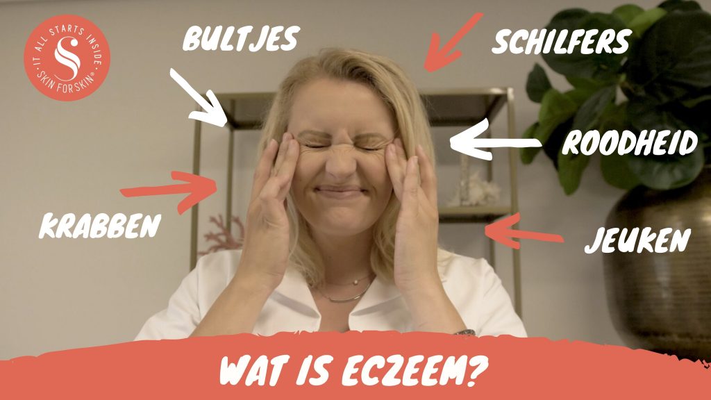 Wat is eczeem?