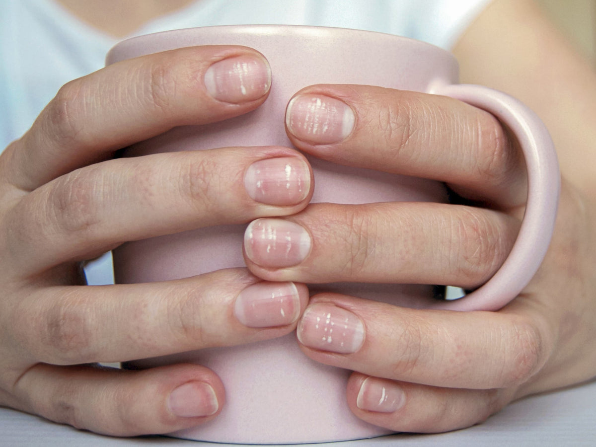 afbeelding van handen met nagels die broos en zwak zijn