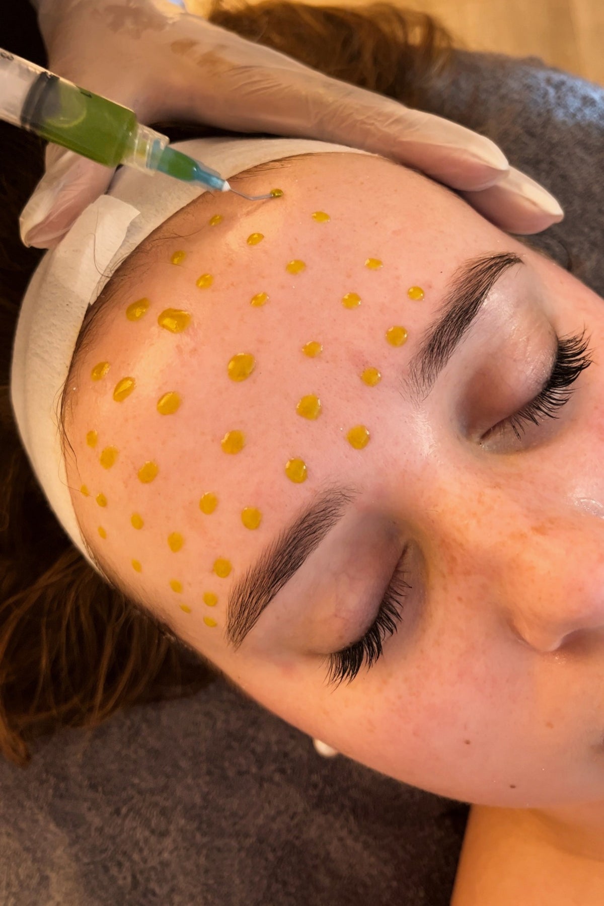 Vrouw met gesloten ogen tijdens een BioRePeel-gezichtsbehandeling in de salon van Skin for Skin
