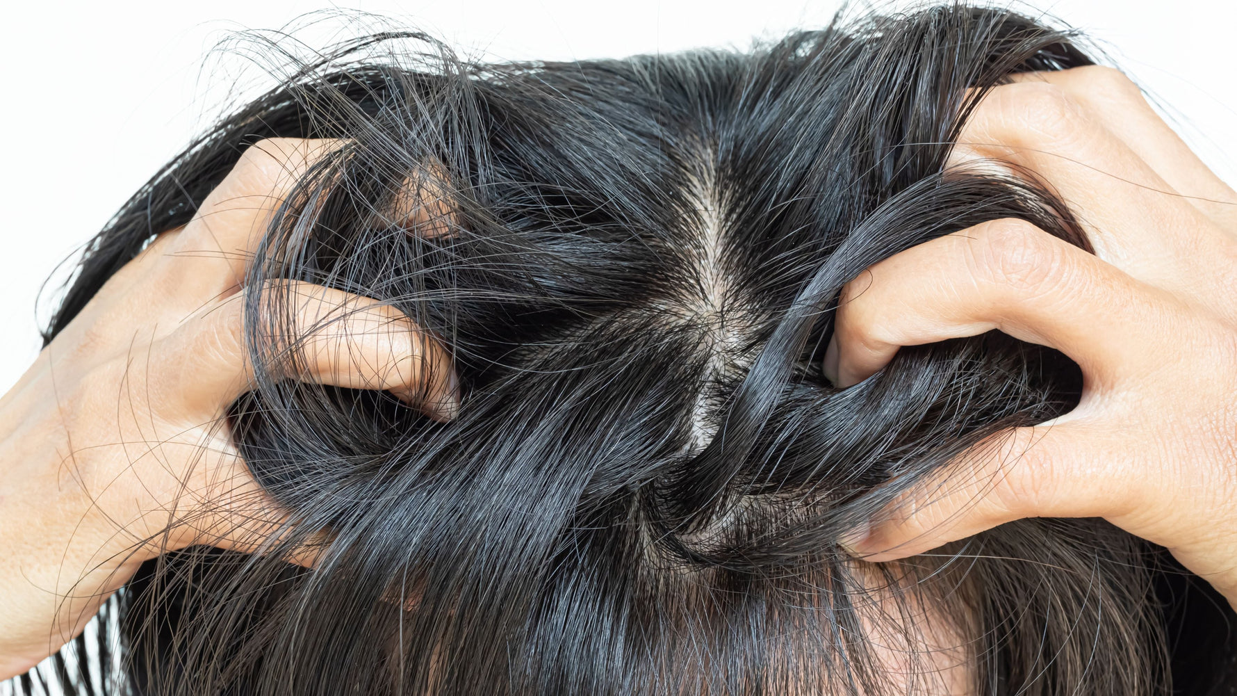 Jeukende hoofdhuid? Oorzaken & tips | Skin for Skin