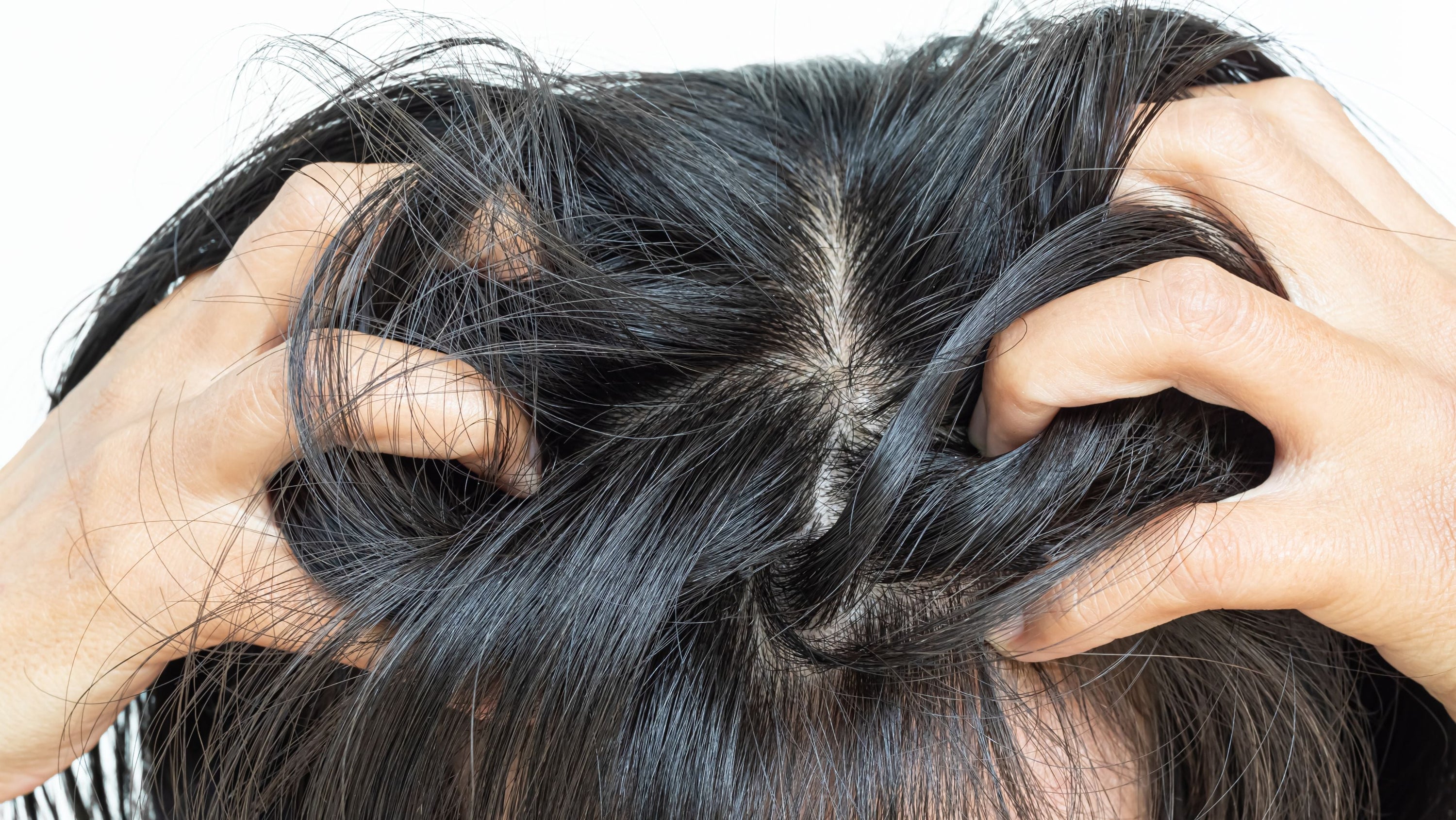 Jeukende hoofdhuid? Oorzaken & tips | Skin for Skin