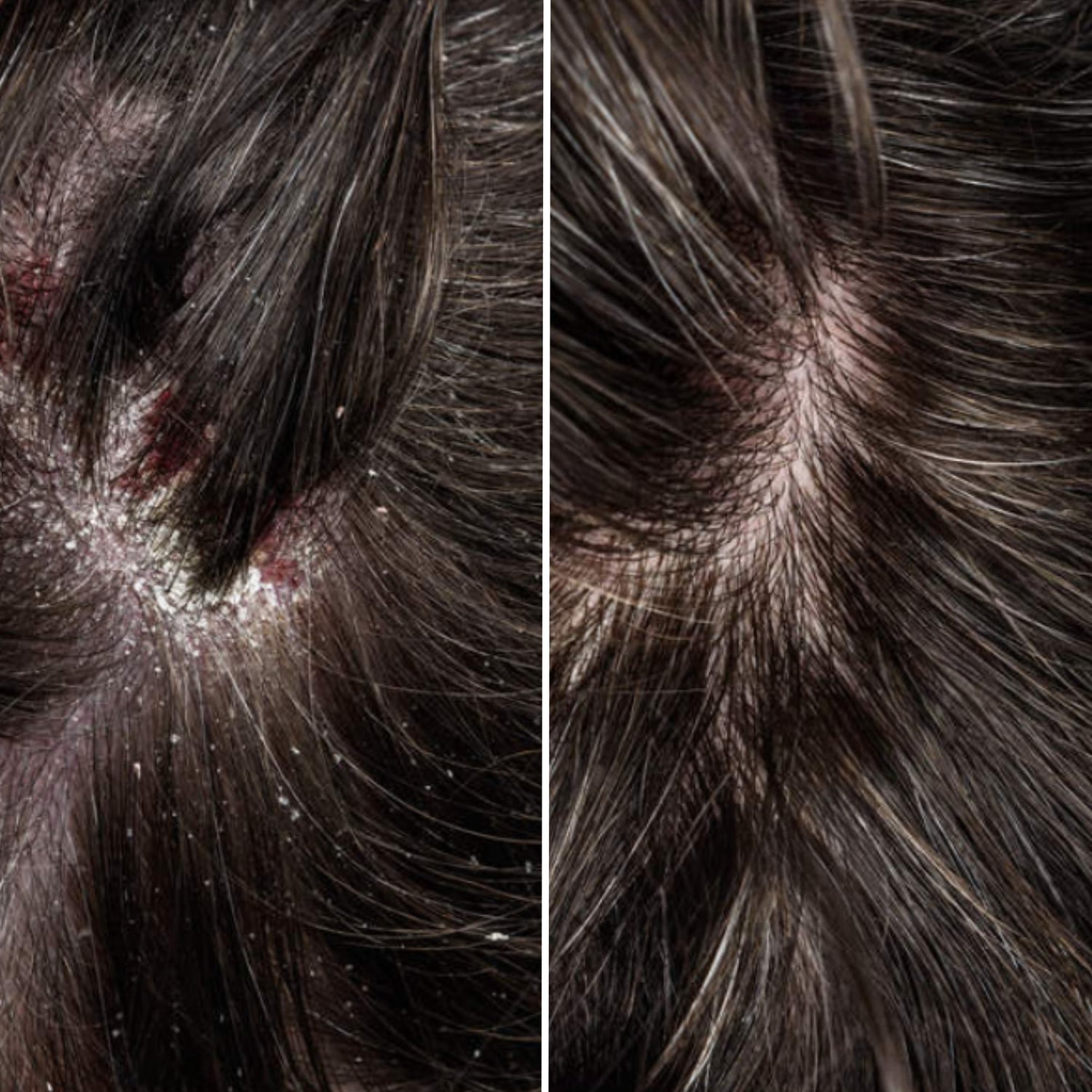 Scalp scrub