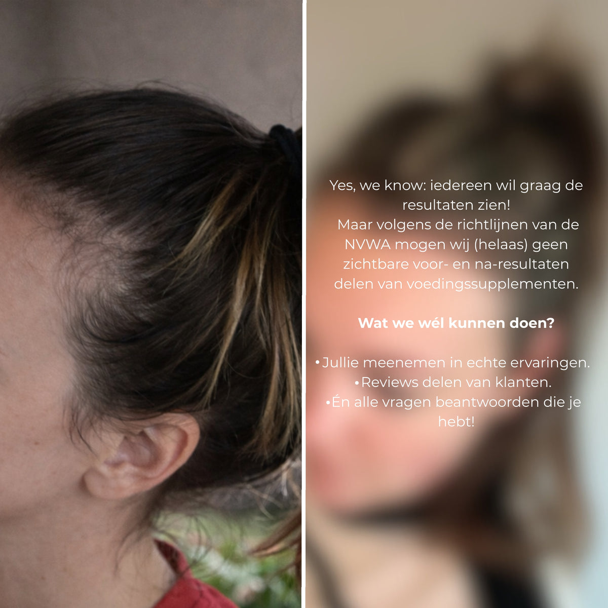 Klant Skin for Skin haar vitamine supplement