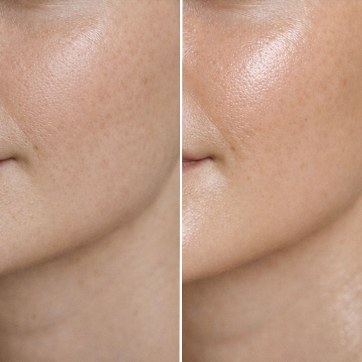 Voor en na beeld van de huid na gebruik van de Barrière Crème van Skin for Skin