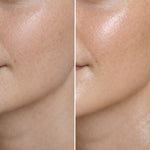 Voor en na beeld van de huid na gebruik van de Barrière Crème van Skin for Skin