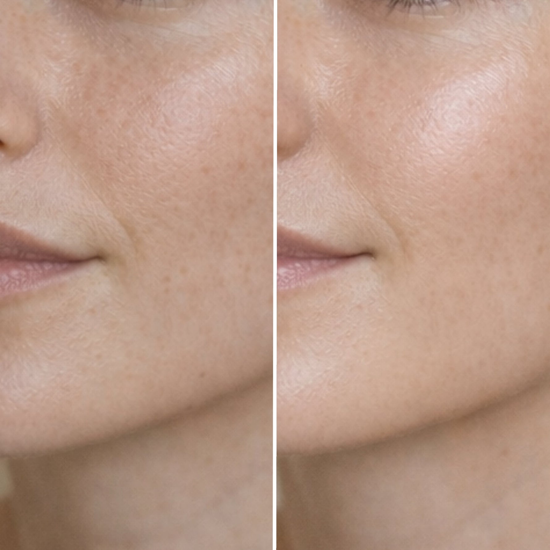 Voor en na beeld van de huid na gebruik van de dagcrème met SPF