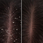Before en after van de hoofdhuid na gebruik van de It Starts at the Roots scalp treatment van Skin for Skin