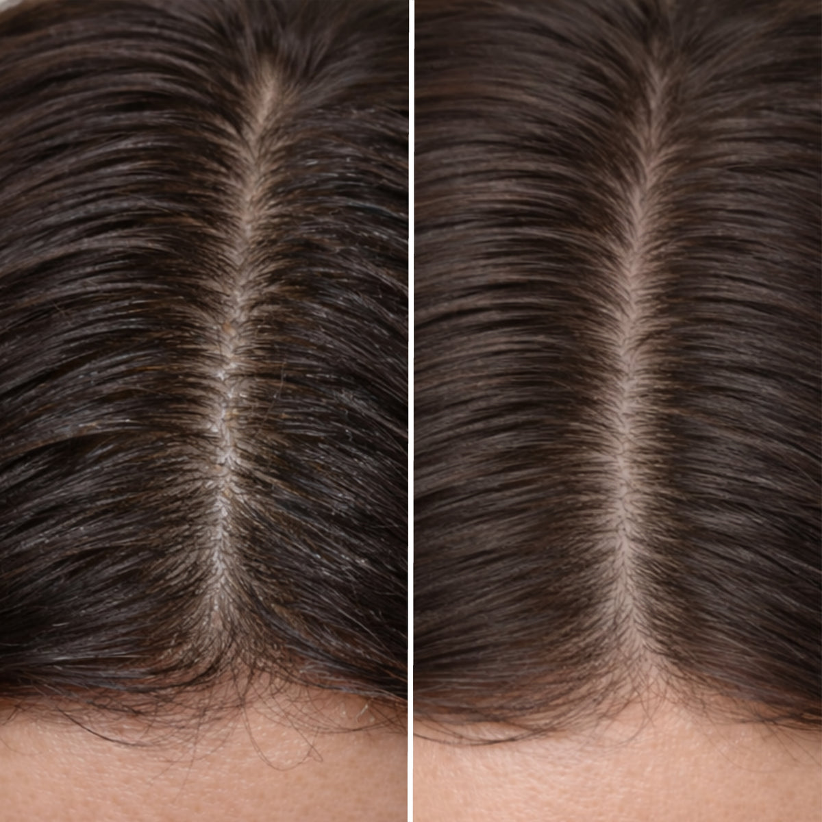 Voor en na beeld van de hoofdhuid na gebruik van de Let’s Do a Deep Cleanse shampoo