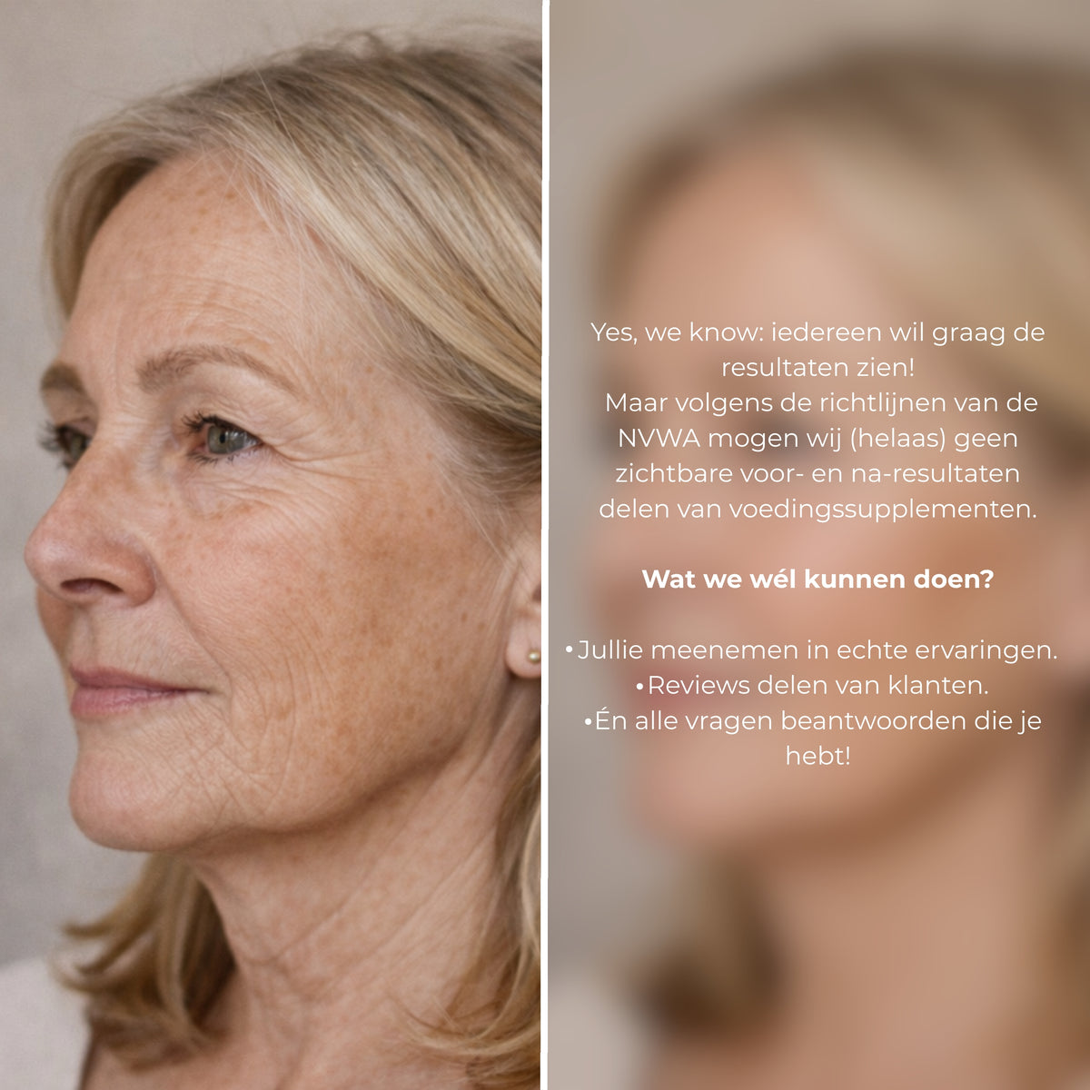 Skin for Skin model natief viscollageen